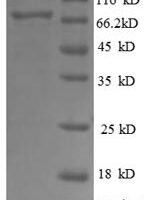 Human Dolichyl-diphosphooligosaccharide--protein glycosyltransferase 48 kDa subunit (RPN1), partial Recombinant Protein - BioCrest Sci