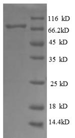 Human Dolichyl-diphosphooligosaccharide--protein glycosyltransferase 48 kDa subunit (RPN1), partial Recombinant Protein, Homo sapiens (Human), E.coli, N-terminal GST-tagged, 70.6 kDa, purity >≥ 90% as determined by SDS-PAGE.
