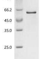 Human Steroid hormone receptor ERR1 (ESRRA) Recombinant Protein, N-His - BioCrest Sci