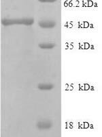 Macaca fascicularis IgG receptor FcRn large subunit p51 (FCGRT), partial Recombinant Protein - BioCrest Sci