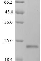 Human Gastrokine-1 (GKN1) Recombinant Protein - BioCrest Sci