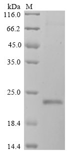 Human Gastrokine-1 (GKN1) Recombinant Protein, Homo sapiens (Human), Mammalian cell, C-terminal 6xHis-tagged, 20.5 kDa, purity >≥ 90% as determined by SDS-PAGE.