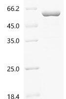 Mouse Histone deacetylase 2 (Hdac2) Recombinant Protein - BioCrest Sci