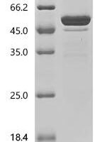 Mouse Fibroblast growth factor 21 (Fgf21) Recombinant Protein, C-hFc1 - BioCrest Sci