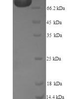 Human Methionine synthase reductase (MTRR) Recombinant Protein, N-His - BioCrest Sci