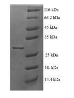 Human 60S ribosomal protein L35a (RPL35A) Recombinant Protein - BioCrest Sci
