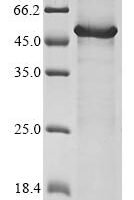 Human Hyaluronidase PH-20 (SPAM1) Recombinant Protein, C-10His - BioCrest Sci