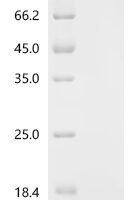 Chicken Insulin-like growth factor I (IGF1) Recombinant Protein - BioCrest Sci