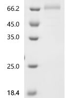 Human Putative butyrophilin-like protein 10 pseudogene (BTNL10P), partial Recombinant Protein, C-mFc2a - BioCrest Sci