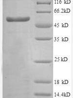 Human Transcription intermediary factor 1-beta (TRIM28), partial Recombinant Protein, N-GST - BioCrest Sci