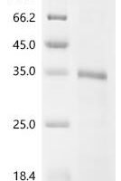 Piscinibacter sakaiensis Poly(ethylene terephthalate) hydrolase, partial Recombinant Protein - BioCrest Sci