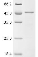 Human Calpain-3 (CAPN3), partial Recombinant Protein - BioCrest Sci