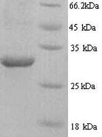 Human HNRNPL protein (HNRNPL), partial Recombinant Protein - BioCrest Sci