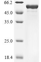 Mouse Glial fibrillary acidic protein (Gfap) Recombinant Protein, N-10His/C-Myc - BioCrest Sci