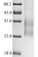 Human Interleukin-31 (IL31) Recombinant Protein - BioCrest Sci