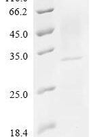 Emericella nidulans Rodlet protein (rodA) Recombinant Protein - BioCrest Sci