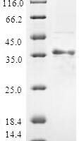 Human ATP synthase-coupling factor 6, mitochondrial (ATP5J) Recombinant Protein - BioCrest Sci