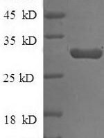 Rabbit Tissue factor pathway inhibitor (TFPI) Recombinant Protein, N-His, aa 25–300a, Yeast - BioCrest Sci