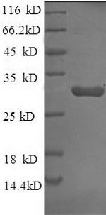 Rabbit Tissue factor pathway inhibitor (TFPI) Recombinant Protein, N-His, aa 25–300a, Yeast, Oryctolagus cuniculus (Rabbit), Yeast, N-terminal 6xHis-tagged, 33.8 kDa, purity >≥ 90% as determined by SDS-PAGE.