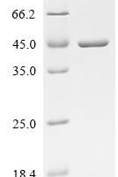 Shigella flexneri Outer membrane protein assembly factor BamC (bamC) Recombinant Protein - BioCrest Sci