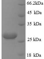 Human Hypoxanthine-guanine phosphoribosyltransferase (HPRT1) Recombinant Protein, N-His - BioCrest Sci