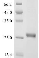 Leishmania infantum Ecotin-like protein 1 (ISP1) Recombinant Protein - BioCrest Sci