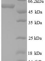 Human Death domain-associated protein 6 (DAXX), partial Recombinant Protein - BioCrest Sci