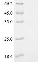 Enterobacteria phage H19B Shiga-like toxin 1 subunit B (stxB) Recombinant Protein, C-10His - BioCrest Sci