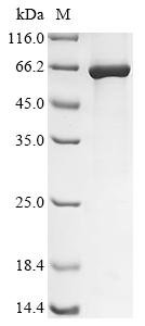 Human adenovirus C serotype 5 Early E1A protein Recombinant Protein, Human adenovirus C serotype 5 (HAdV-5) (Human adenovirus 5), E.coli, N-terminal 6xHis-SUMO-tagged, 44.8 kDa, purity >≥ 85% as determined by SDS-PAGE.