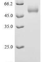Human Interleukin-15 (IL15), Biotinylated Recombinant Protein - BioCrest Sci