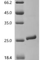 Human Integrin alpha-L (ITGAL), partial Recombinant Protein, N-His - BioCrest Sci