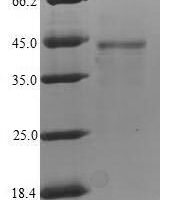Human Fc receptor-like protein 4 (FCRL4) Recombinant Protein - BioCrest Sci