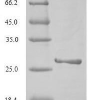 Influenza A virus Non-structural protein 1 (NS) Recombinant Protein, N-His, aa 1–237, Yeast - BioCrest Sci
