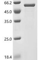 Human Keratin, type I cytoskeletal 17 (KRT17) Recombinant Protein - BioCrest Sci