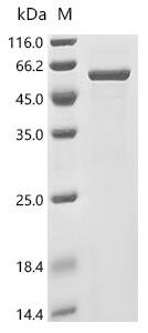 Human Keratin, type I cytoskeletal 17 (KRT17) Recombinant Protein, Homo sapiens (Human), E.coli, C-terminal 6xHis-tagged, 55.0 kDa, purity >≥ 90% as determined by SDS-PAGE.