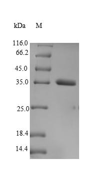 Human Transcription cofactor vestigial-like protein 3 (VGLL3) Recombinant Protein, N-His, aa 1–320, Yeast - BioCrest Sci
