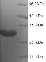Human Nanos homolog 2 (NANOS2) Recombinant Protein - BioCrest Sci