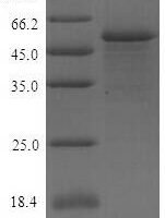 Human Poliovirus receptor (PVR), partial Recombinant Protein - BioCrest Sci