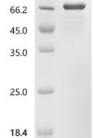 Human F-box only protein 2 (FBXO2) Recombinant Protein, C-GST - BioCrest Sci