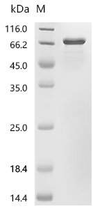 Human F-box only protein 2 (FBXO2) Recombinant Protein, C-GST, Homo sapiens (Human), E.coli, C-terminal GST-tagged, 64.9 kDa, purity >≥ 85% as determined by SDS-PAGE.