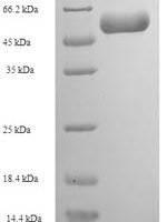 Rabies virus Nucleoprotein (N) Recombinant Protein, N-His, aa 1–450, E.coli - BioCrest Sci