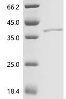 Drosophila melanogaster Tyrosine-protein kinase hopscotch (hop), partial Recombinant Protein, N-His/C-His - BioCrest Sci