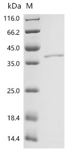 Drosophila melanogaster Tyrosine-protein kinase hopscotch (hop), partial Recombinant Protein, N-His/C-His, Drosophila melanogaster (Fruit fly), E.coli, N-terminal 6xHis-tagged and C-terminal 6xHis-tagged, 40.7 kDa, purity >≥ 90% as determined by SDS-PAGE.