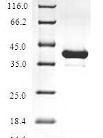 Human Hemoglobin subunit zeta (HBZ) Recombinant Protein - BioCrest Sci