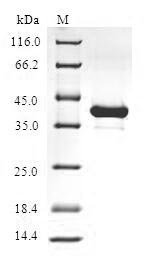 Human Hemoglobin subunit zeta (HBZ) Recombinant Protein, Homo sapiens (Human), E.coli, N-terminal GST-tagged, 42.5 kDa, purity >≥ 90% as determined by SDS-PAGE.