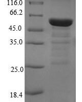 Human Eukaryotic translation initiation factor 3 subunit M (EIF3M) Recombinant Protein - BioCrest Sci