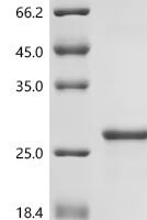 Drosophila melanogaster Profilin (chic) Recombinant Protein, N-His/C-His - BioCrest Sci