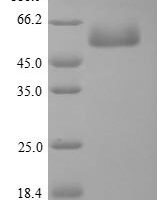 Chicken Focal adhesion kinase 1 (PTK2), partial Recombinant Protein - BioCrest Sci