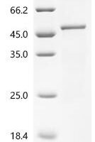 Human Flavin-containing monooxygenase 3 (FMO3), partial Recombinant Protein - BioCrest Sci