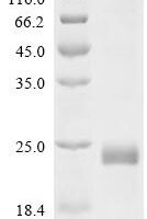 Human Tumor necrosis factor receptor superfamily member 10D (TNFRSF10D), partial Recombinant Protein, N-His-SUMO - BioCrest Sci